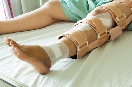 Exploring Non-Economic Damages in Florida Personal Injury Lawsuits